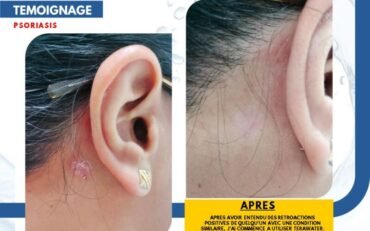 TeraWater-Testimonial-4-800x500 (1)